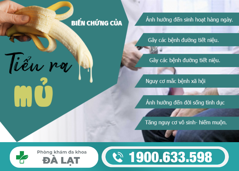 Hình ảnh minh họa